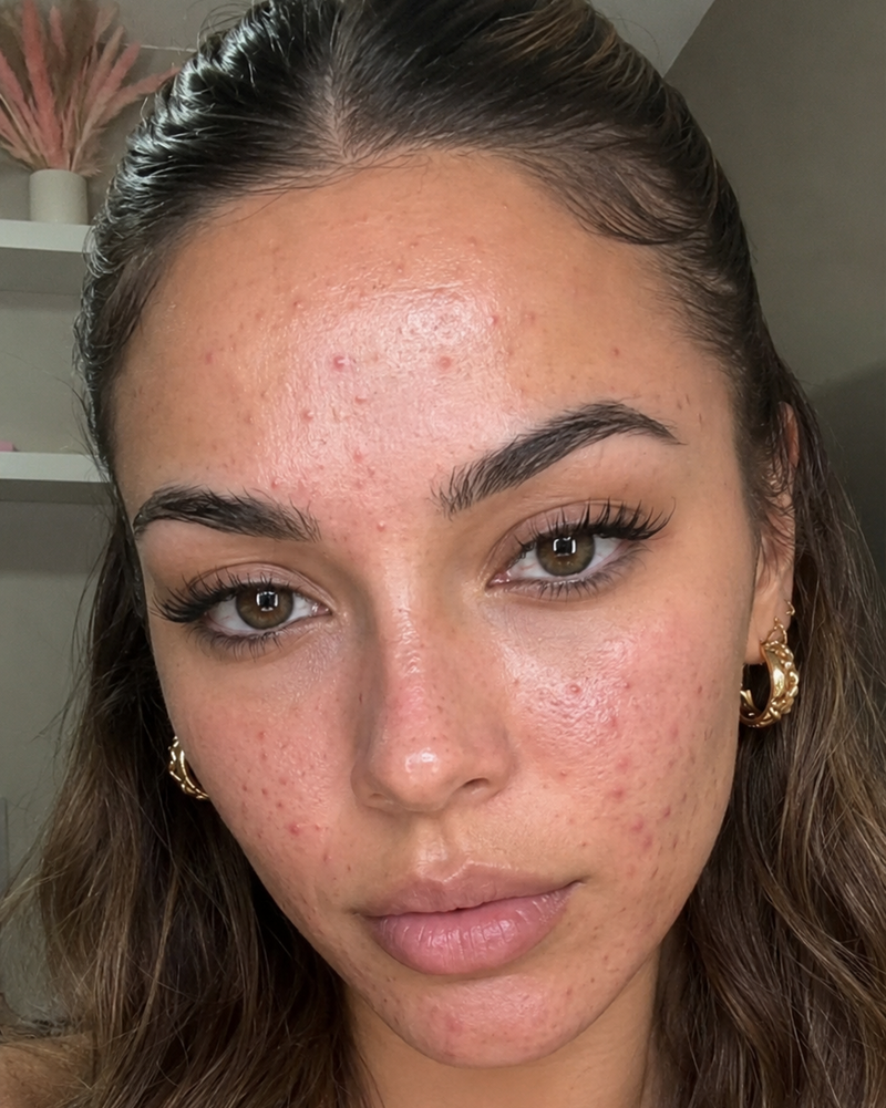 Day 1